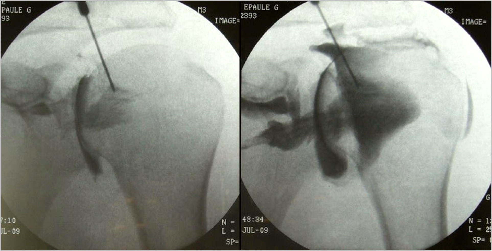 Resume Objective Examples For Ultrasound